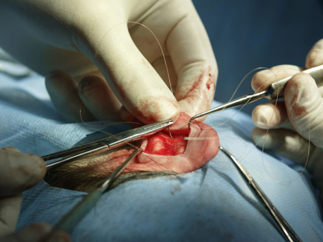 EAR-NOSE-AND-THROAT-SURGERY