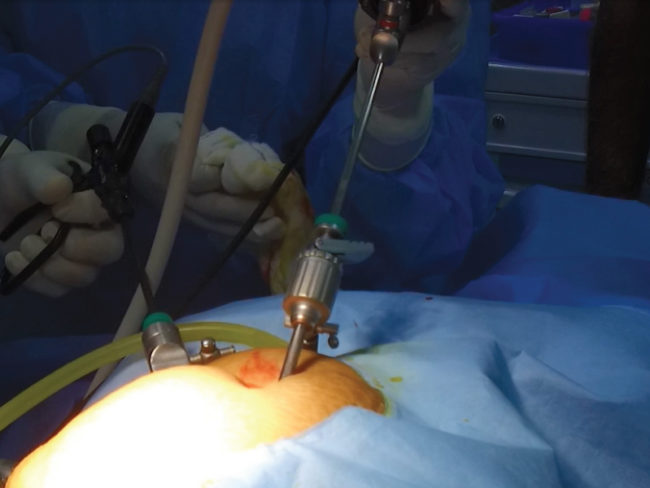GENERAL-AND-LAPAROSCOPIC-SURGERY